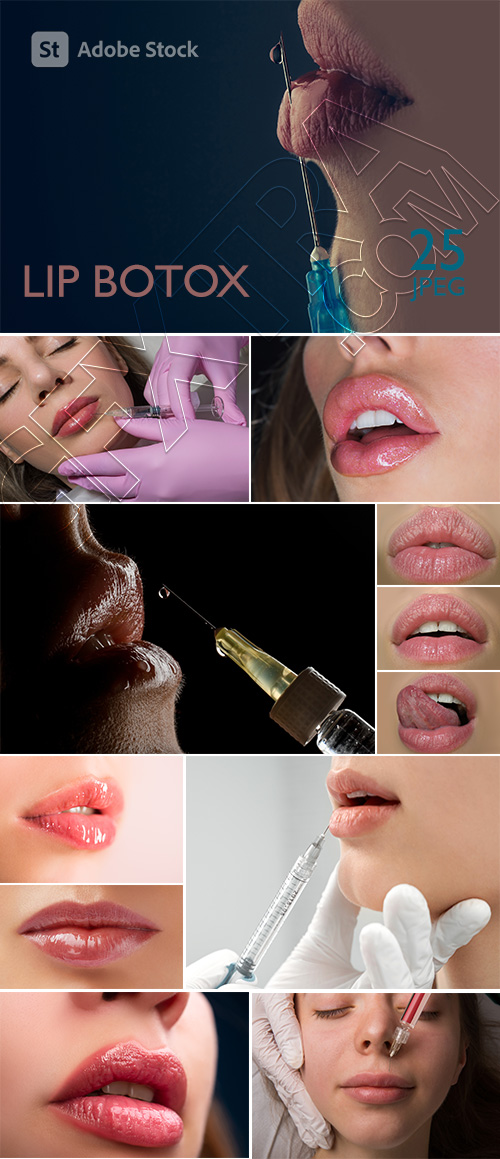 Lip Botox 25xJPG Lip Botox 25xJPG
