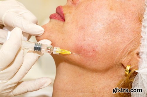 Amazing SS - Treatment with botox, 25xJPGs