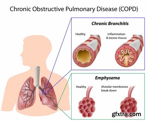 Medical Infographics - 25x EPS