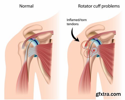 Medical Infographics - 25x EPS