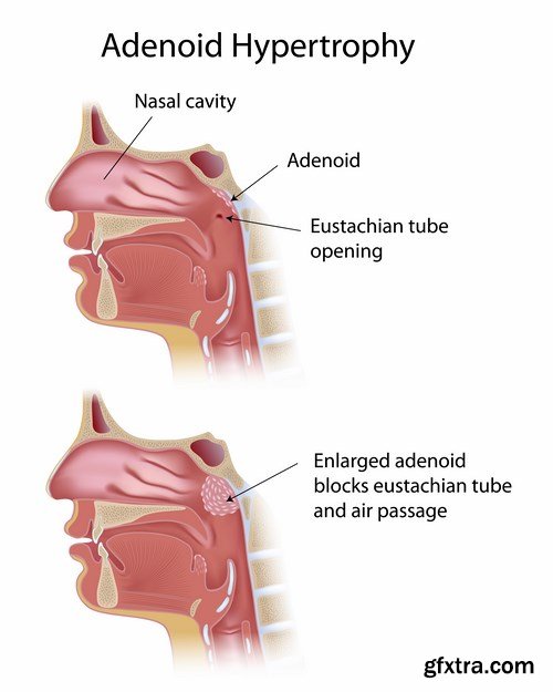 Medical Infographics - 25x EPS