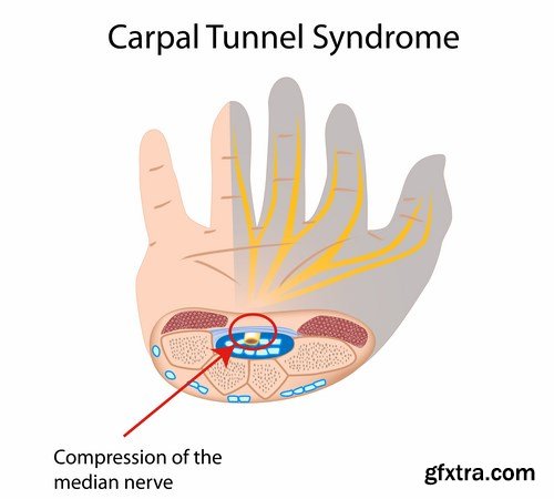 Medical Infographics - 25x EPS