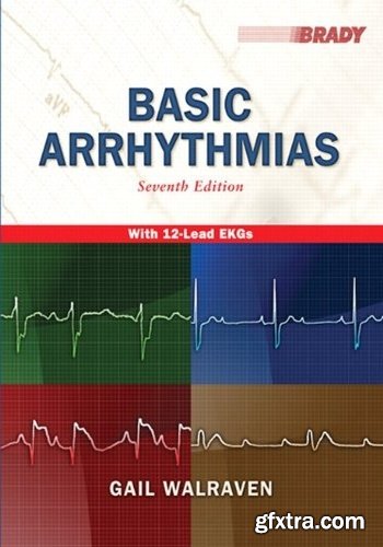 Basic Arrhythmias, 7th Edition