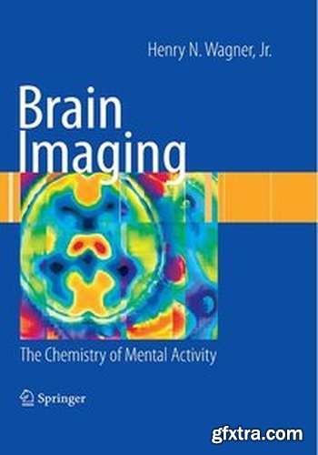 Brain Imaging: The Chemistry of Mental Activity