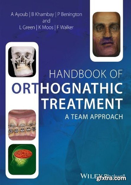 Handbook of Orthognathic Treatment - A team approach