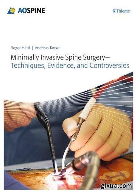 Minimally Invasive Spine Surgery