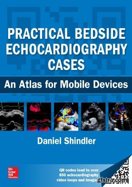 Practical Bedside Echocardiography Cases