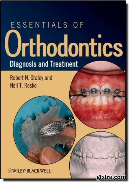 Essentials of Orthodontics: Diagnosis and Treatment