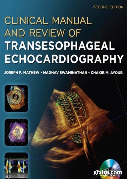 Clinical Manual and Review of Transesophageal Echocardiography, Second Edition