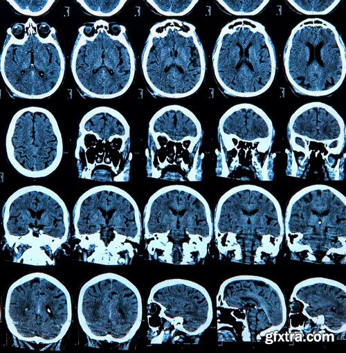 Stock Photos - X-ray, Roentgenogram, 25xJPG