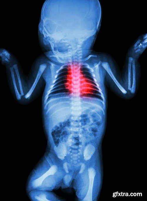 Stock Photos - X-ray, Roentgenogram, 25xJPG