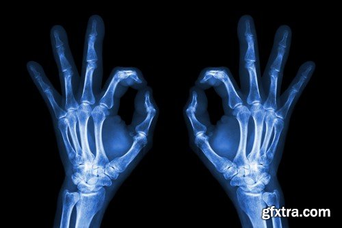 Stock Photos - X-ray, Roentgenogram, 25xJPG