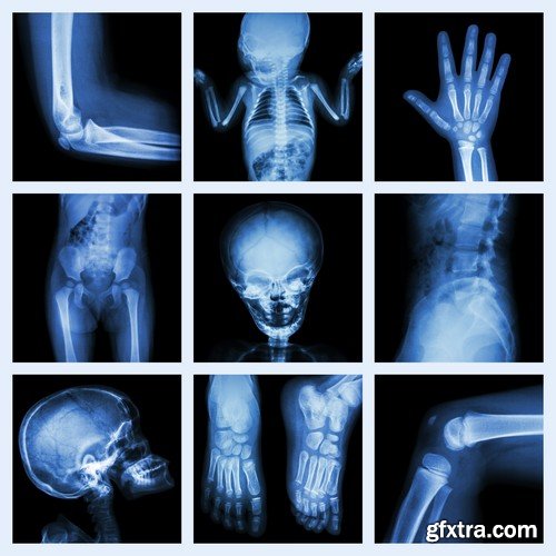 Stock Photos - X-ray, Roentgenogram, 25xJPG