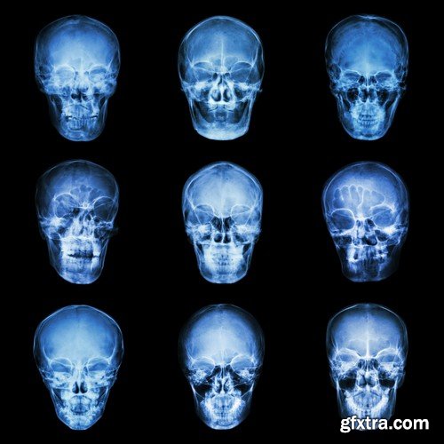 Stock Photos - X-ray, Roentgenogram, 25xJPG