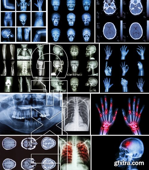 Stock Photos - X-ray, Roentgenogram, 25xJPG