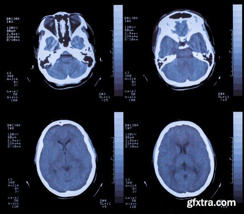 Stock Photos - X-ray, Roentgenogram, 25xJPG