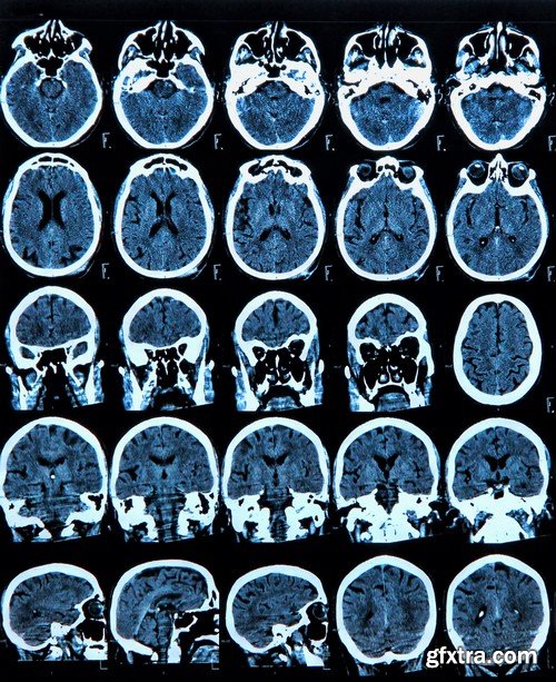 Stock Photos - X-ray, Roentgenogram, 25xJPG