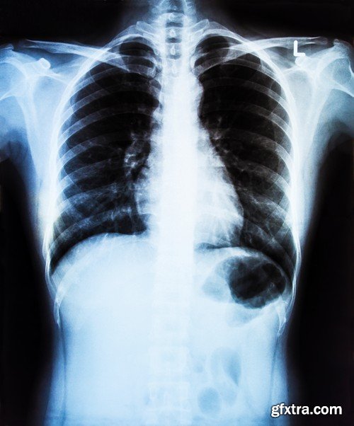 Stock Photos - X-ray, Roentgenogram, 25xJPG