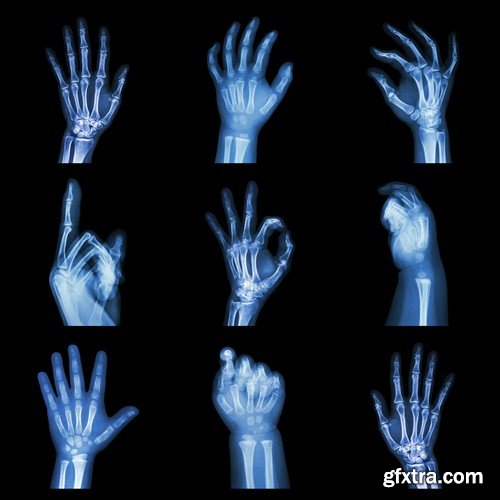 Stock Photos - X-ray, Roentgenogram, 25xJPG