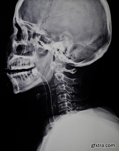 Stock Photos - X-ray, Roentgenogram, 25xJPG