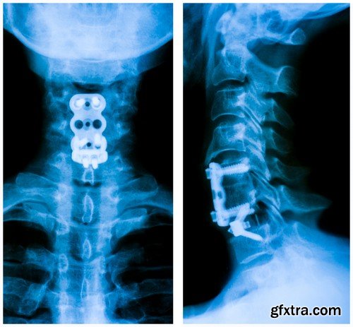 Stock Photos - X-ray, Roentgenogram, 25xJPG