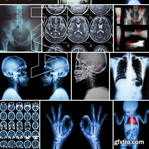 Stock Photos - X-ray, Roentgenogram, 25xJPG