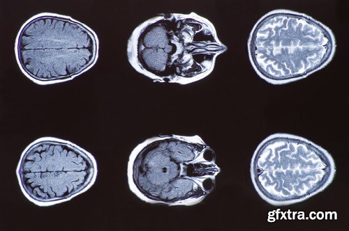 Stock Photos - X-ray, Roentgenogram, 25xJPG