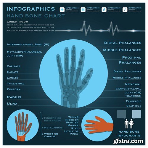 Medical Infographics, 25xEPS