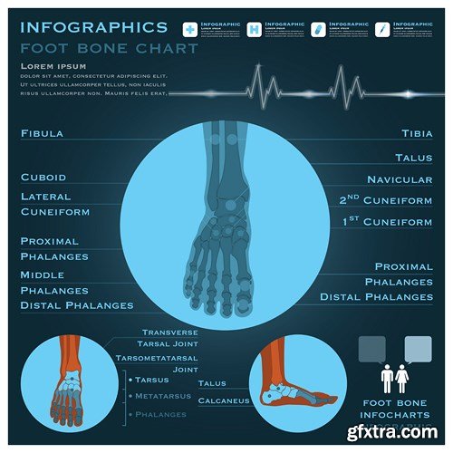 Medical Infographics, 25xEPS