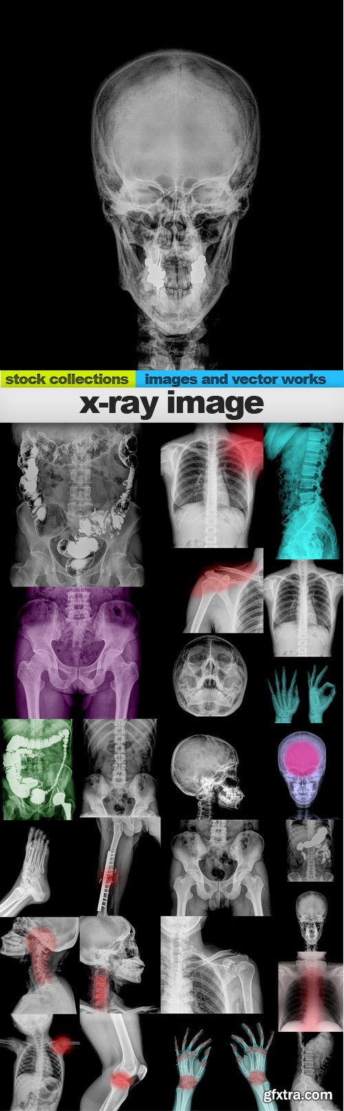 X-ray image,25 x UHQ JPEG