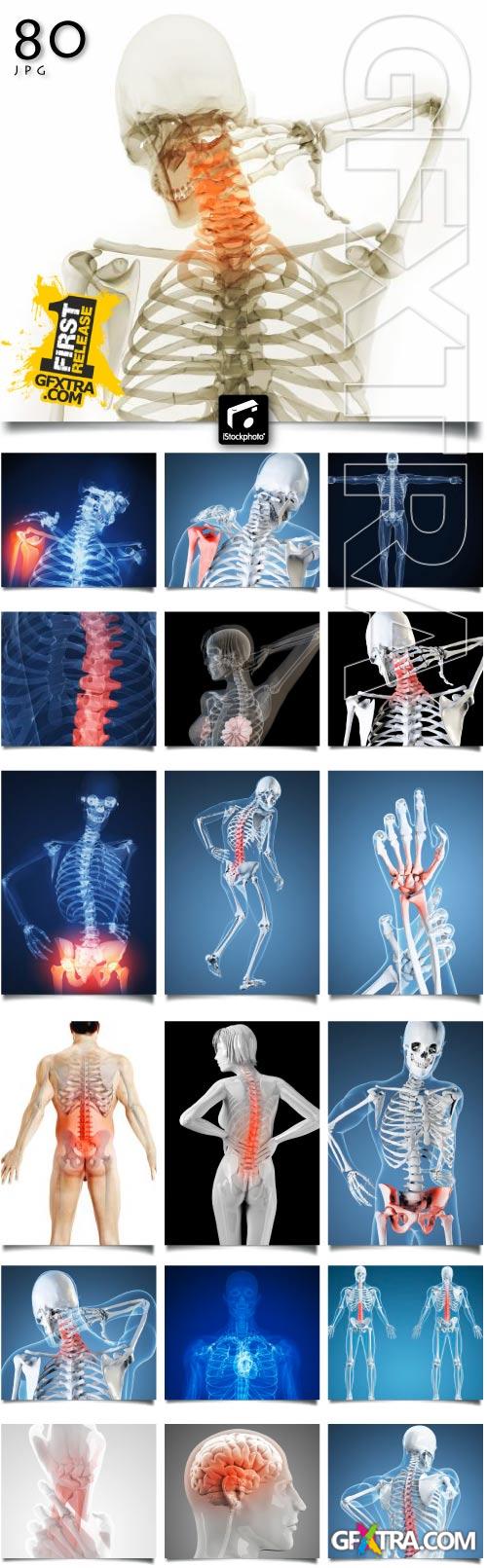 XRAY Body Collection 80xJPG