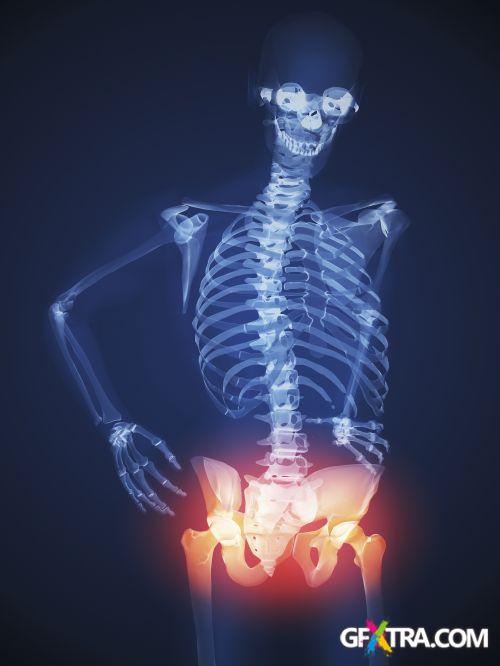 XRAY Body Collection 80xJPG