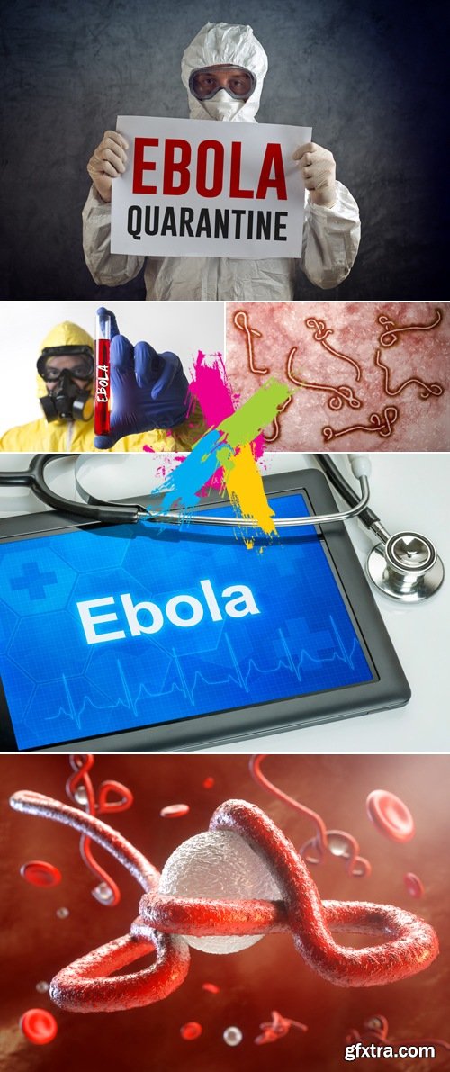 Stock Photo - Ebola Virus