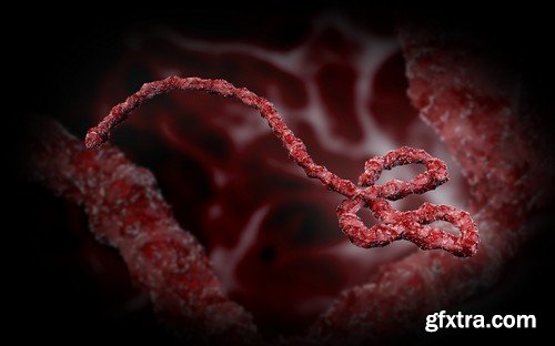 Stock Photos - Ebola, 25xJPG