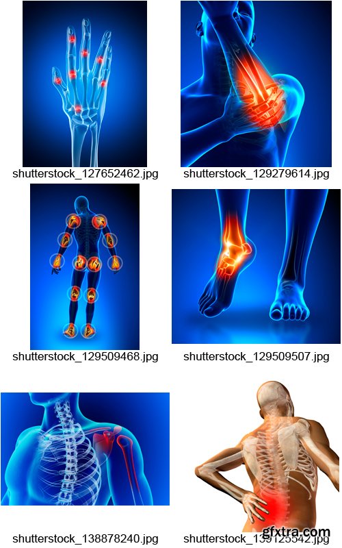 Amazing SS - Joint Pain, 25xJPGs