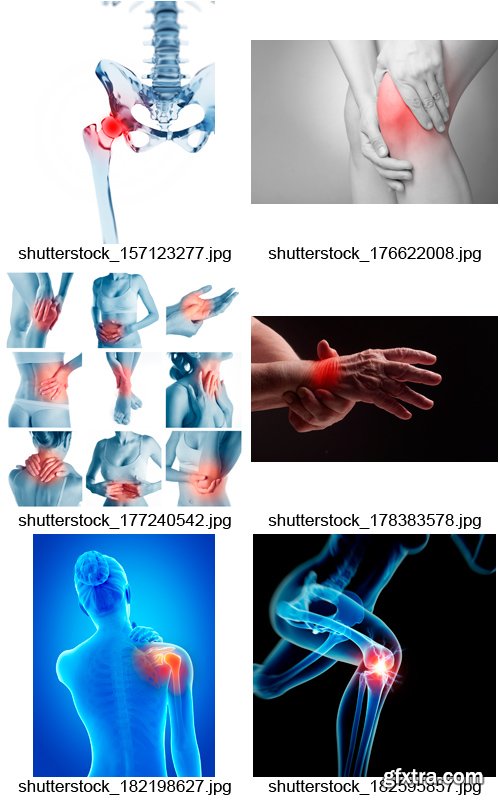 Amazing SS - Joint Pain, 25xJPGs