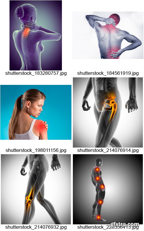 Amazing SS - Joint Pain, 25xJPGs