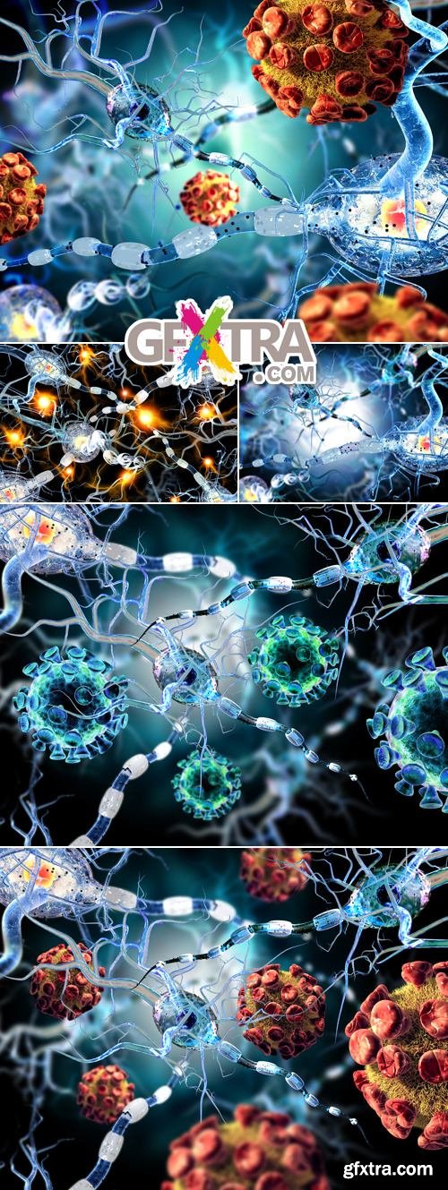 Stock Photo - Neurologic Diseases - Medical Concept