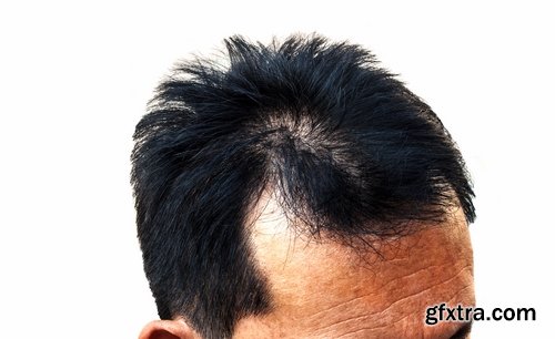 Collection bald head hairstyle hair dandruff scalp massage 25 HQ Jpeg