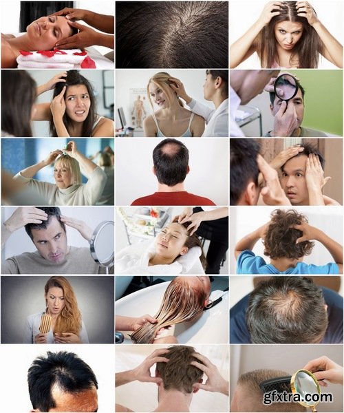 Collection bald head hairstyle hair dandruff scalp massage 25 HQ Jpeg
