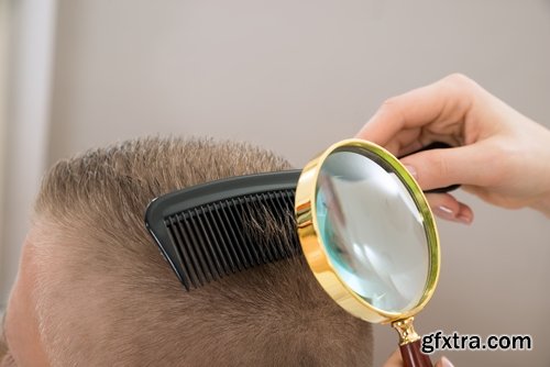 Collection bald head hairstyle hair dandruff scalp massage 25 HQ Jpeg