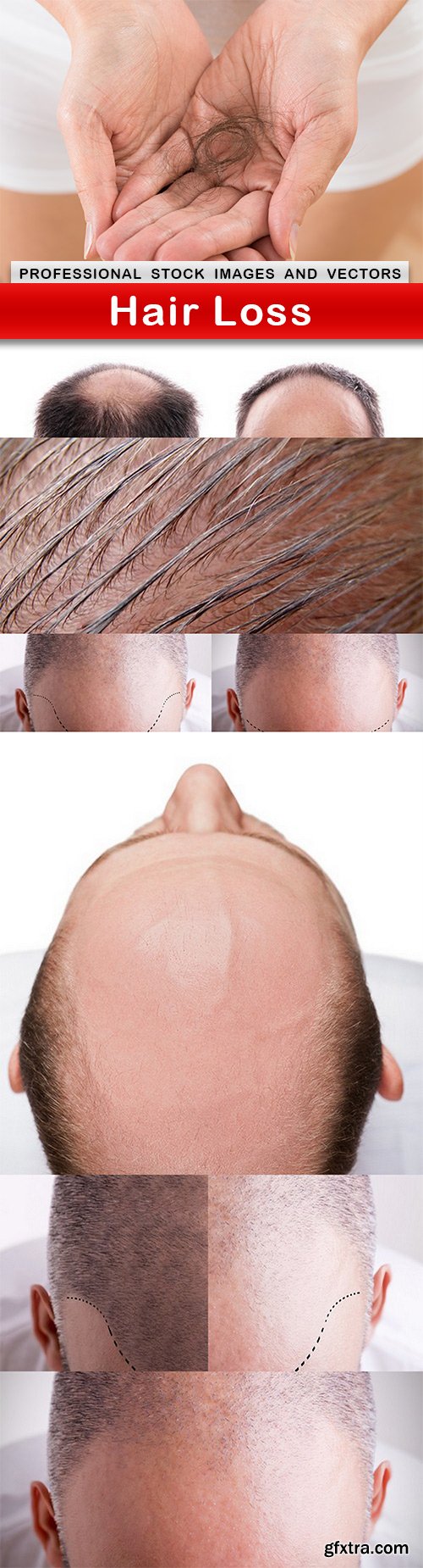 Hair Loss - 8 UHQ JPEG