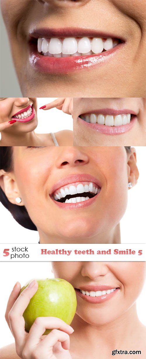 Photos - Healthy teeth and Smile 5