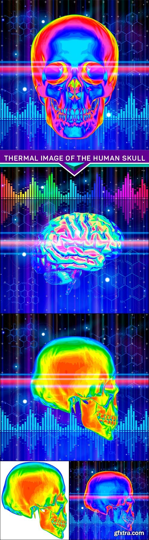 Thermal image of the human skull 5X EPS