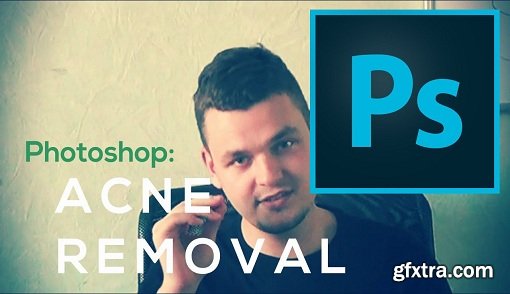 Photoshop: Easiest Way To Remove Acne