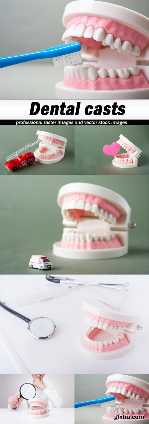 Dental casts - 6 UHQ JPEG