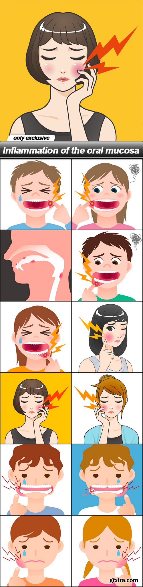 Inflammation of the oral mucosa - 12 EPS