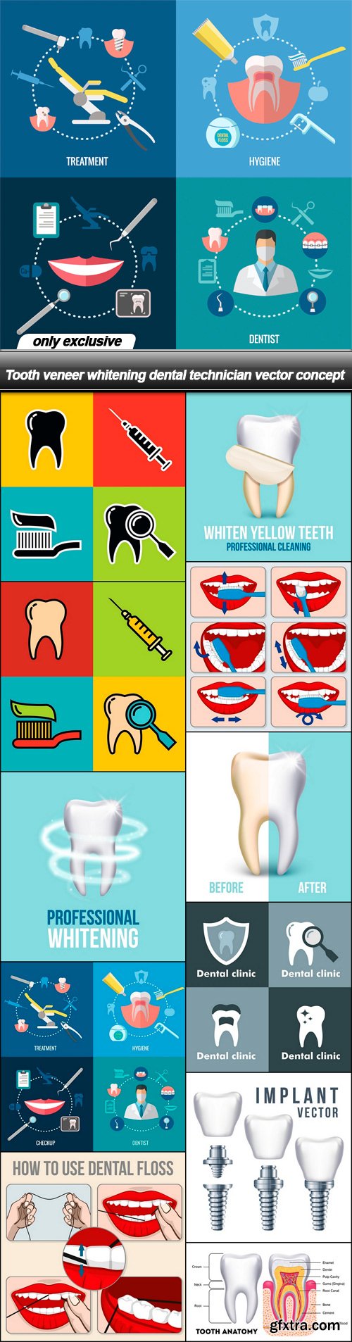 Tooth veneer whitening dental technician vector concept - 11 EPS