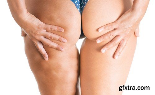 Problem of cellulite - 6 UHQ JPEG