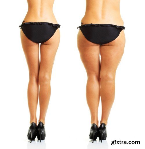 Problem of cellulite - 6 UHQ JPEG